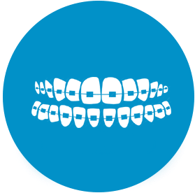 Braces For Kids And Adults - Cherrycrest Dental Centre